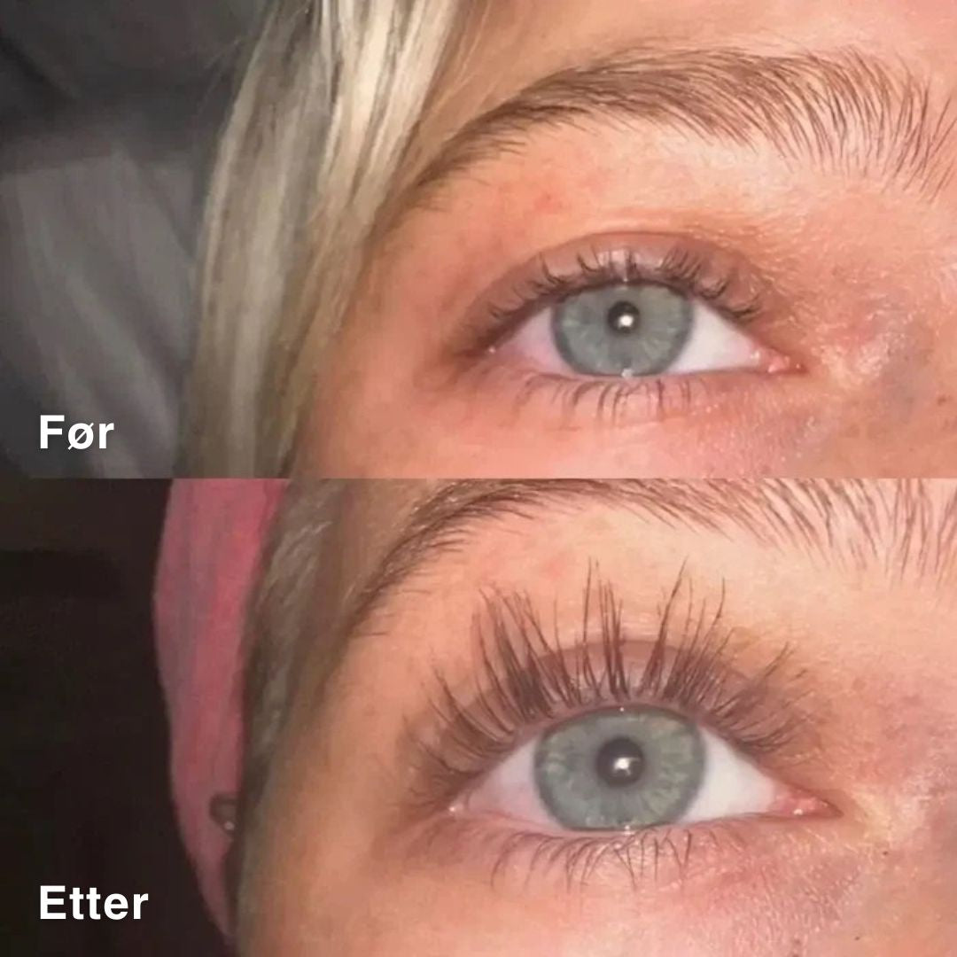 Vippeserum for lengre og fyldigere vipper