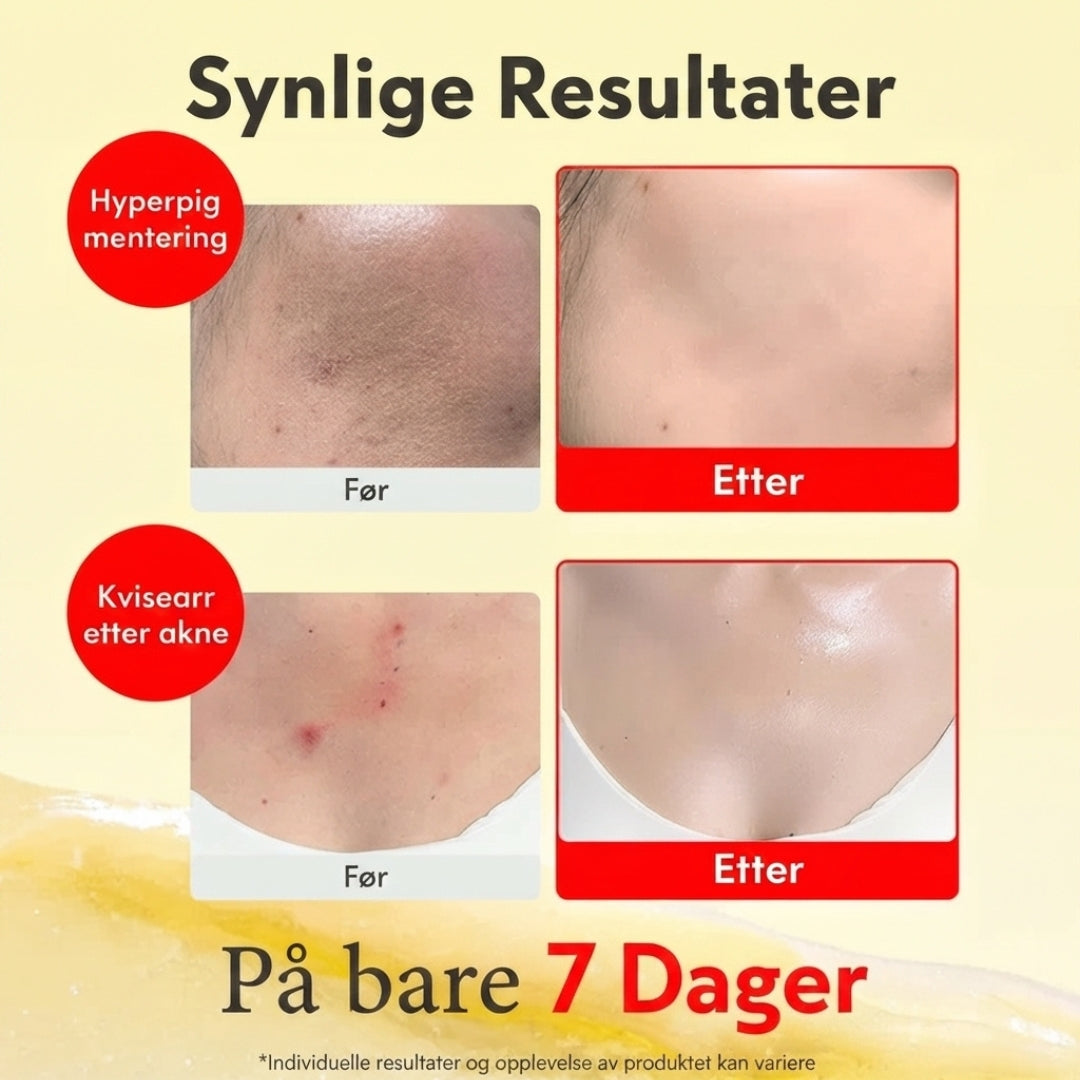 Glødgivende Vitaminserum & Krem-sett