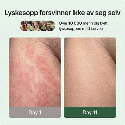 Lorvea Soppdempende Såpe