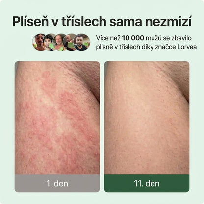 Lorvea Protiplísňové Mýdlo