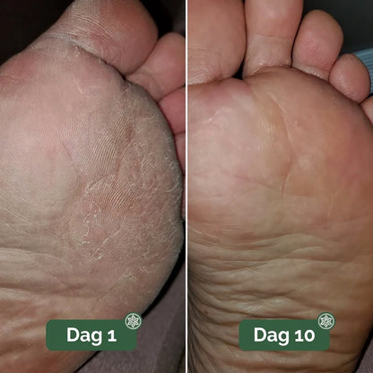 Lorvea Soppdempende Såpe®