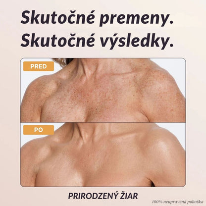 Lorvea Okamžitý Telesný Korektor