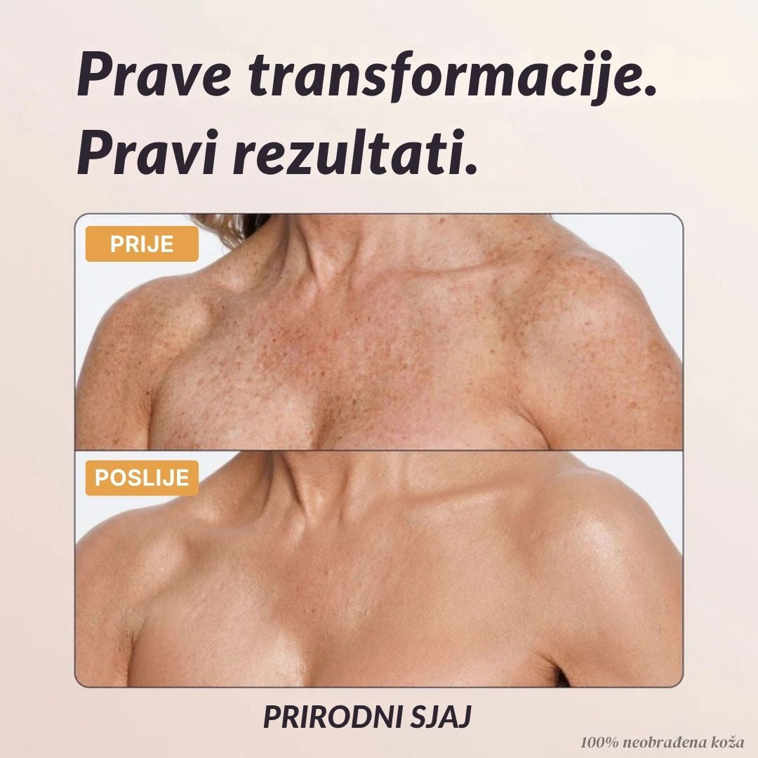 Lorvea Trenutni Korektor za Tijelo