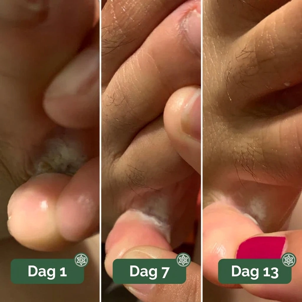 Lorvea Soppdempende Såpe®