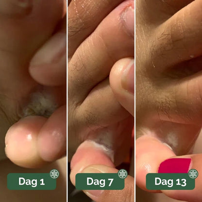 Lorvea Soppdempende Såpe®