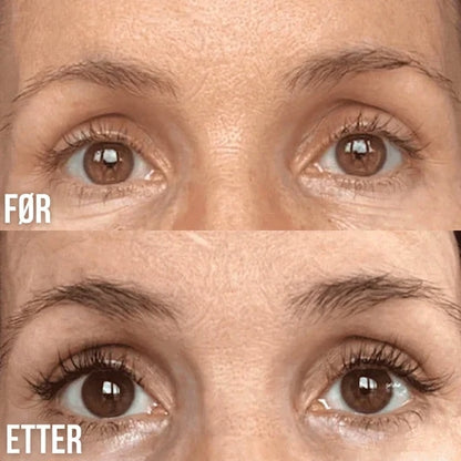 Lorvea Koreansk Vippeserum