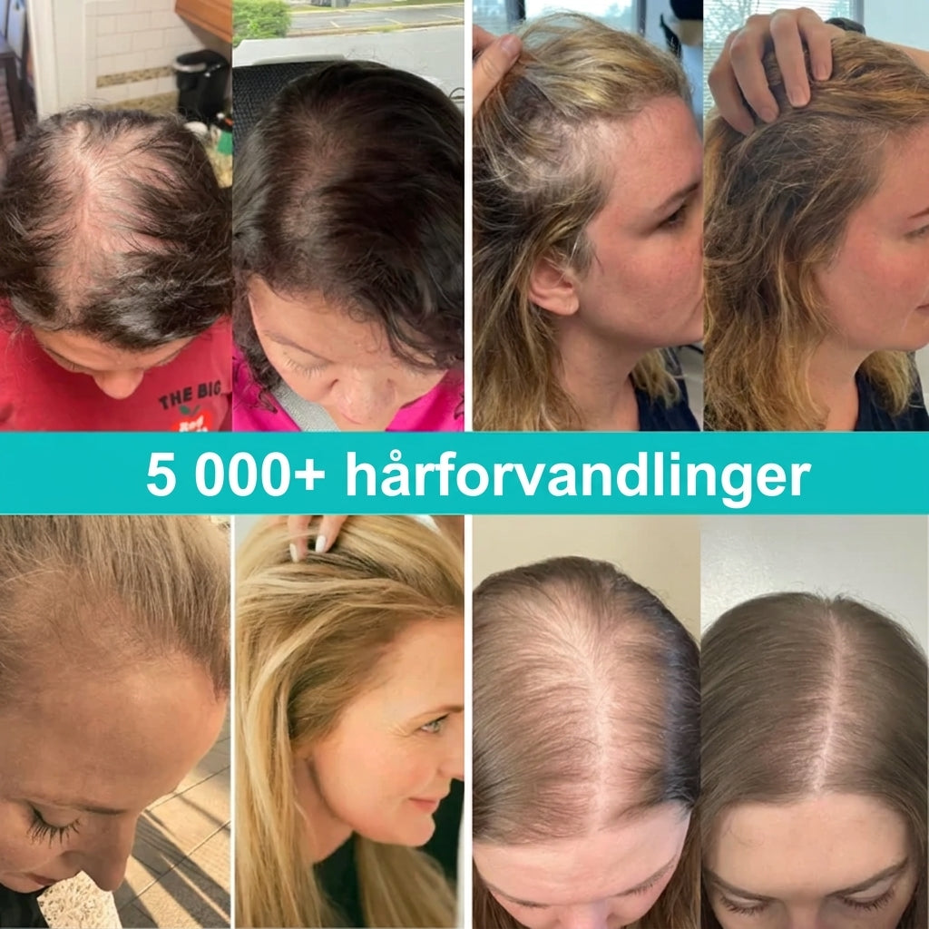 Lorvea PDRN Reedle Shot Hårserum