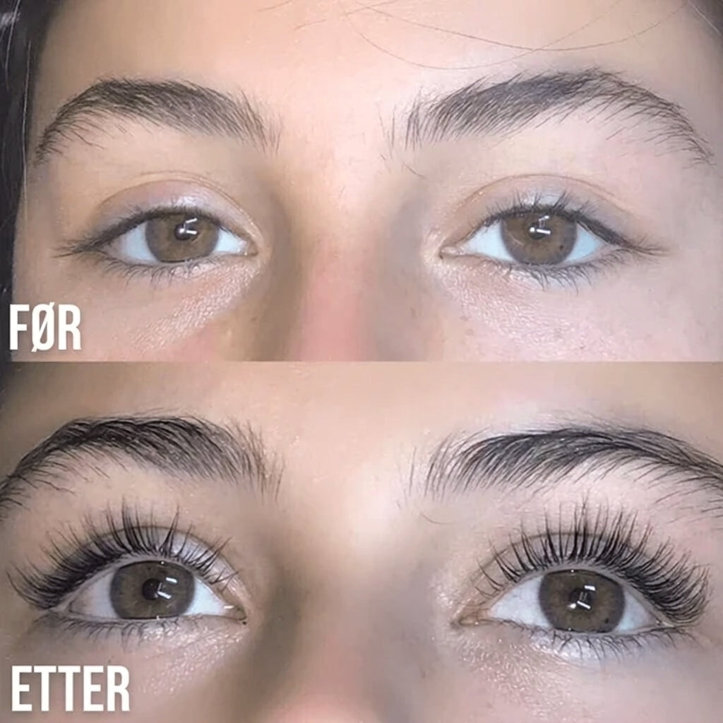 Lorvea Koreansk Vippeserum