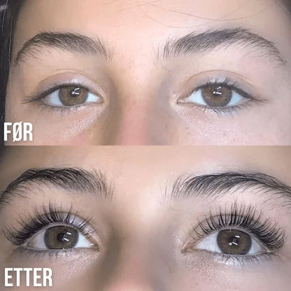 Lorvea Koreansk Vippeserum